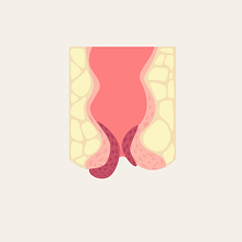 Post instagram carrossel limpeza de pele marrom e bege - 53.png