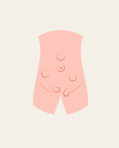 Post instagram carrossel limpeza de pele marrom e bege - 50.png