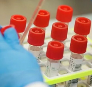 За лаштунками Вінницького онкодиспансеру: чому головного лікаря тестують на COVID-19 тричі