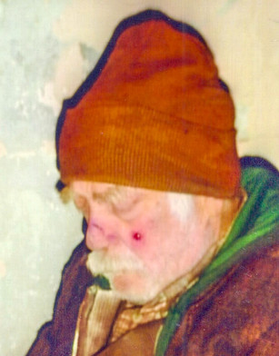 Old man with bruises and facial hair