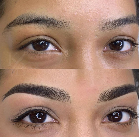 Combo eyebrow before/after