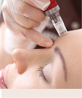 Microneedling.jpg
