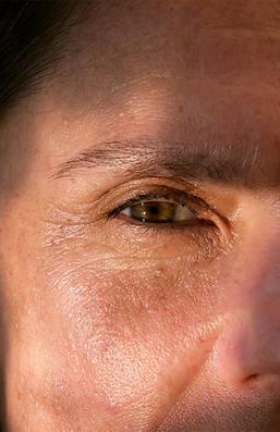 WRINKLE-REDUCTION.png