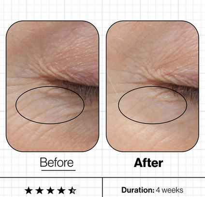 Before and after images showing the positive effect Skin Youth Biome has had
