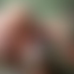 A healthcare professional examines a bald man’s ear with an otoscope in a clinical setting, supporting routine hearing health checks and early detection.