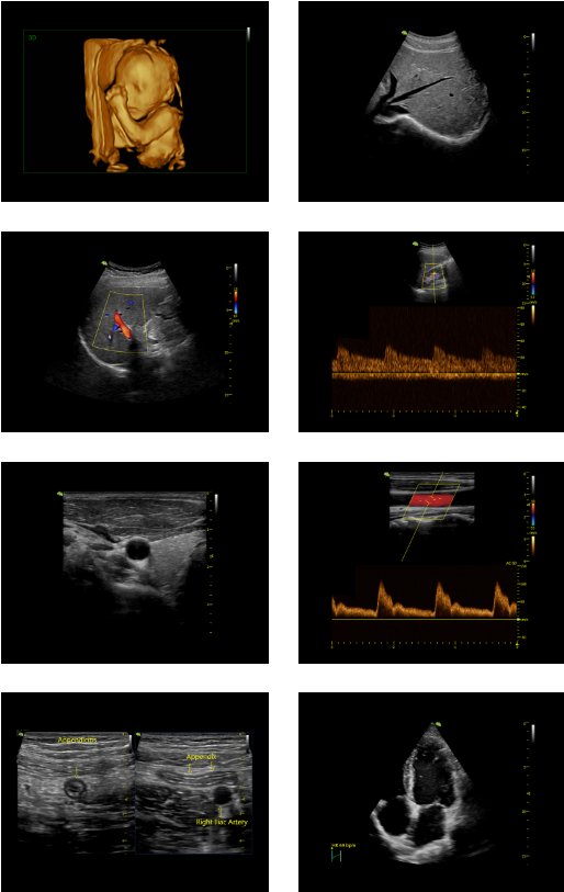 Vinno E35 Sample Images