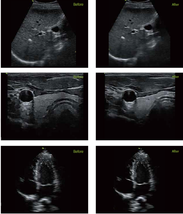Vinno Q Active Image Denoising