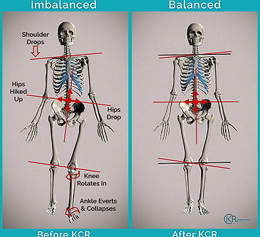 Niðurstöður fyrir og eftir grunnþjálfun með hreyfigetu (KCR) sem sýna bætta líkamsstöðu og líkamsstöðu