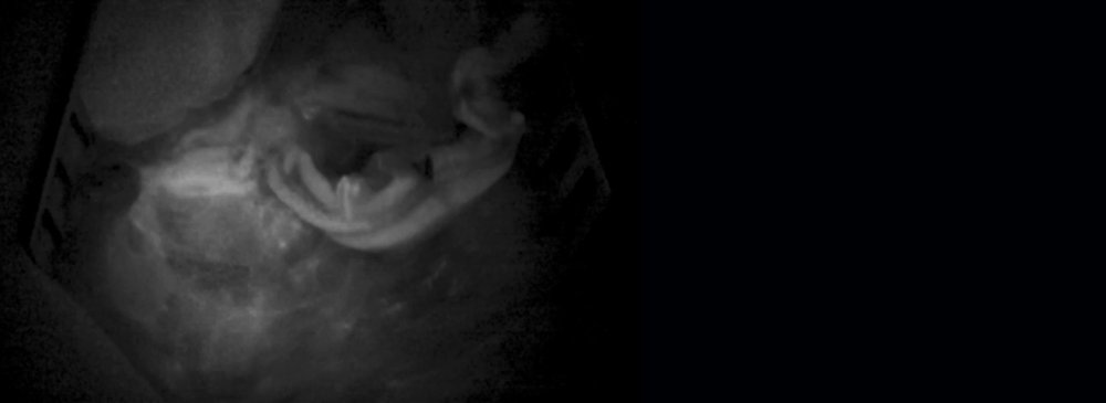 FL800 intraoperative video-angiography module
