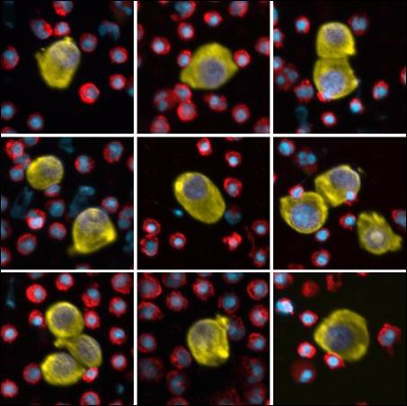 Microsieve chips for cell isolation