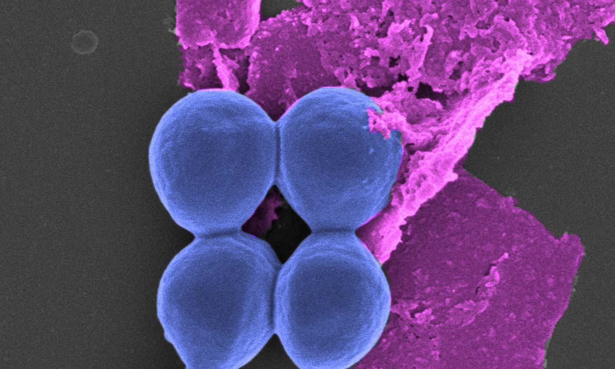 The ball shapes are bacteria and the “sheet” is black phosphorus, under the microscope at RMIT University. (Note these images have been coloured in post-production.) @ Aaron Elbourne and colleagues, RMIT University