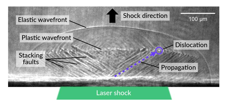 This X-ray radiographic image – similar to a medical X-ray, but taken at ultrafast speed with an X-ray laser – shows shock waves traveling through a diamond crystal. The initial wave is elastic. The plastic wave follows, creating defects in the material called dislocations that propagate through the material faster than the speed of sound. The arrow shows the path and direction of one dislocation, which has left a linear defect called a stacking fault in its wake. The dislocation itself is seen at the tip of the arrow. Other stacking faults can be seen fanning out from the site of the laser shock. (K. Katagiri/Stanford University)