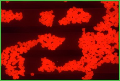 MuScan for Microplastics