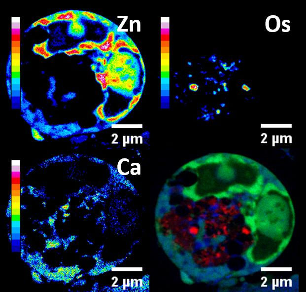 Ovarian cancer cells under nano-focus (2 micron scale), are showing FY26, zinc and calcium. @ University of Warwick