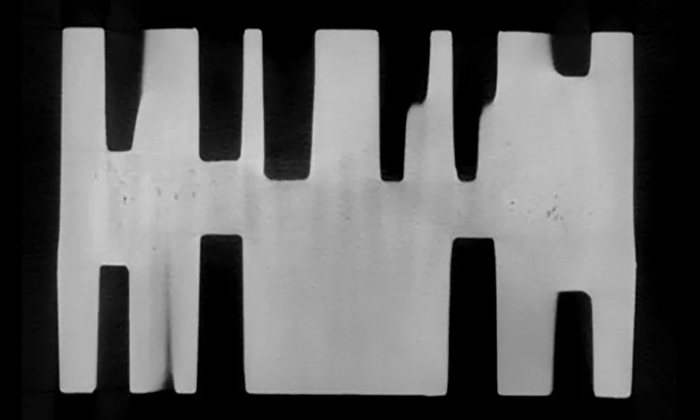 Metal artifact reduction (MAR)