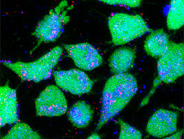 Fighting cancer with sticky nanoparticles