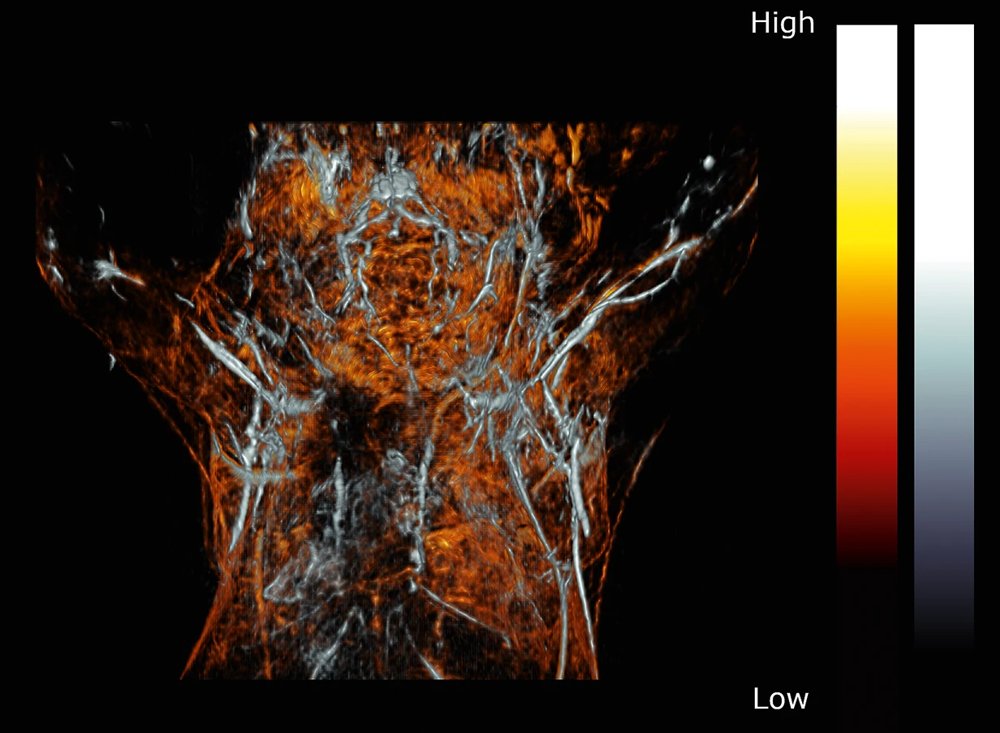 PhotoSonus M High Energy, Mobile, Tunable Wavelength Laser Source for Photoacoustic Imaging