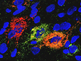 The brain can induce diabetes remission in rodents, but how?