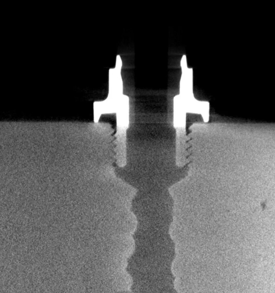 High Density Power (HDP) Target for the 225 kV X-ray tube