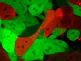 Red Glow Helps Identify Nanoparticles for Delivering RNA Therapies