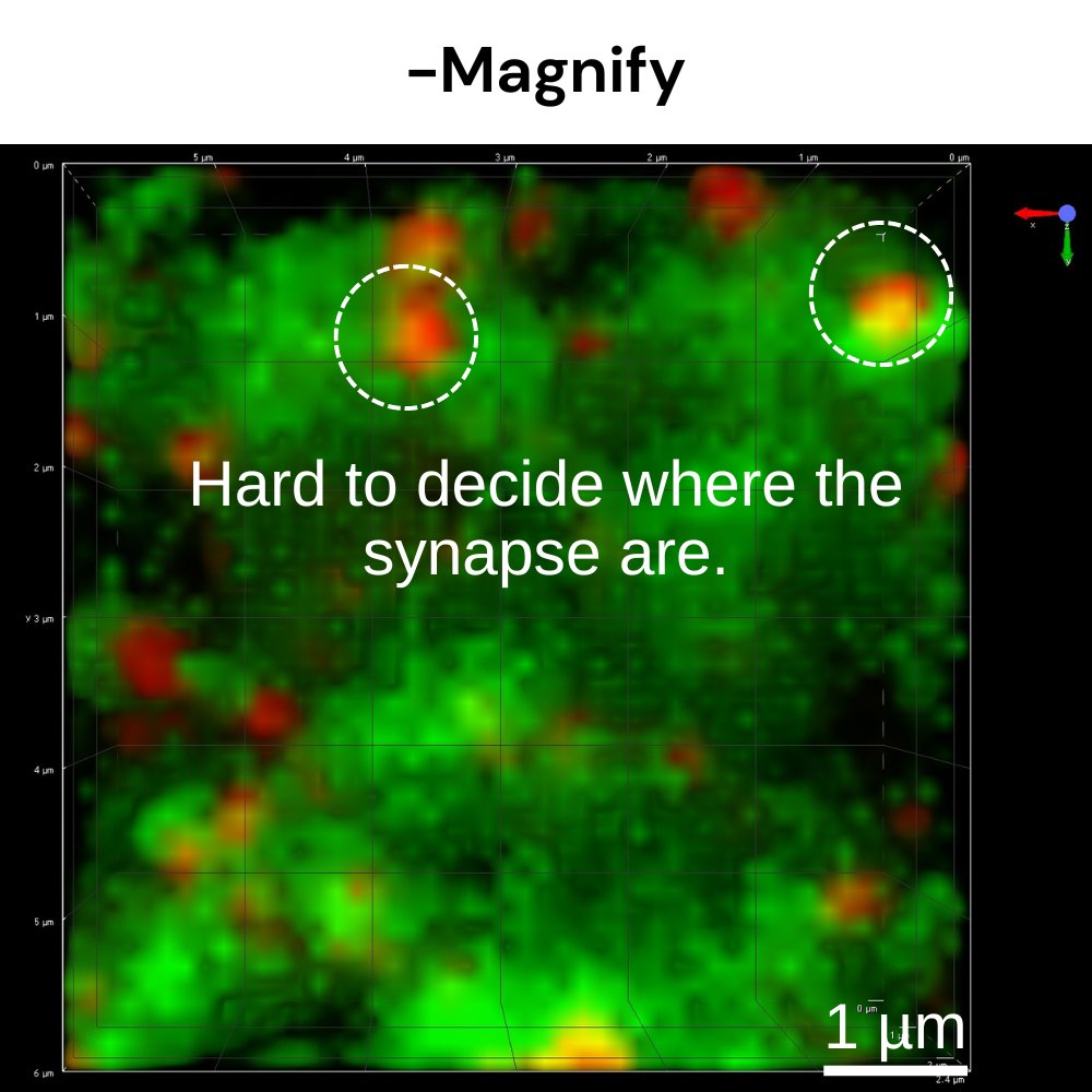 Magnify™ Expansion Kit
