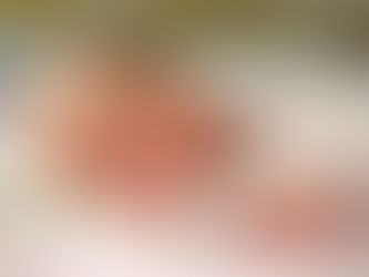 UTHealth research looks at nanotechnology to help prevent preterm birth