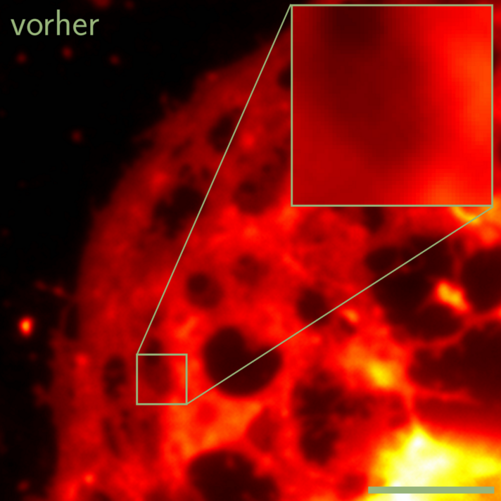 The images show a liver cell before and after processing the data with the software developed at Bielefeld University. Photo. Bielefeld University