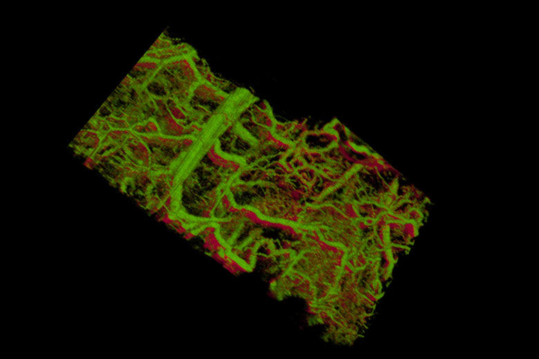 Gold nanorods within the blood vessels of a mouse ear appear green. The lower right shows vessels within a tumor that lies under the skin.