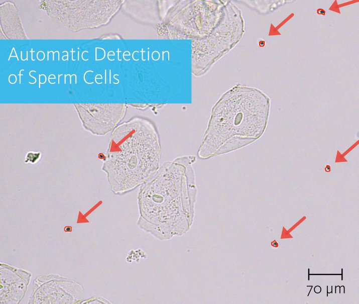 MMI CellDetector