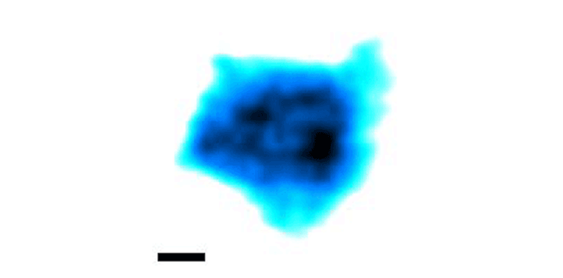 Video imaging by high-speed AFM captures native nuclear pore complexes at work; the inset scale bar is 10 nanometers. (Image: University of Basel)