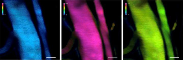 Laser scanning microscope images of blood vessels in a mouse following treatment. © 2019 Kanjiro Miyata