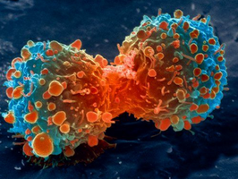 Magnetic nanoparticles may reveal early traces of cancer