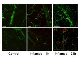 Nanoscale Trojan horses treat inflammation