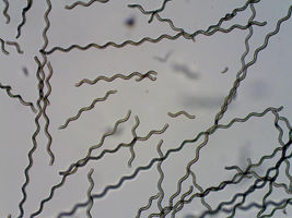 Tiny robots step closer to treating hard-to-reach parts of the body
