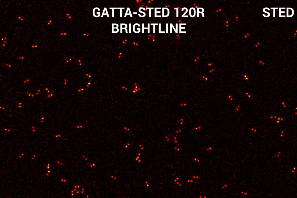 GATTA-STED - brightline