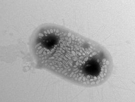 Scientists design bacteria to reflect 'sonar' signals for ultrasound imaging