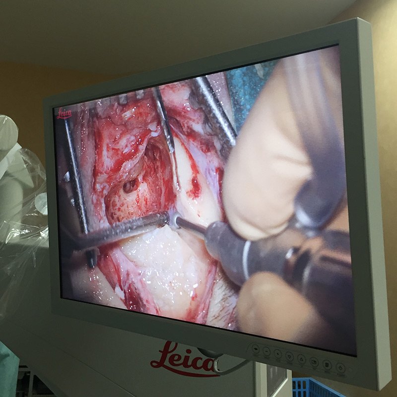 PROvido multidisciplinary surgical microscope