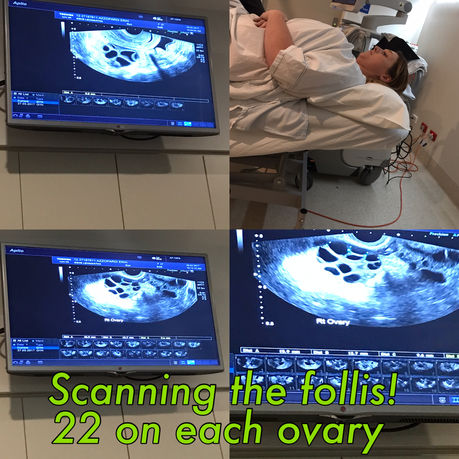 The next step after needles! Egg pick up