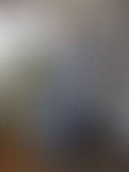 ぎっくり腰はクセになるから気を付けて！　元から正せば怖くない‼