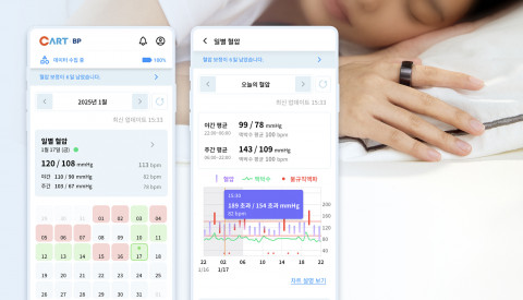 스카이랩스, 반지형 혈압계 ‘카트 비피’ 공식 출시