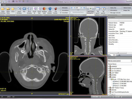 DICOM Viewer Crack Torrent (Activation Code) Free Download