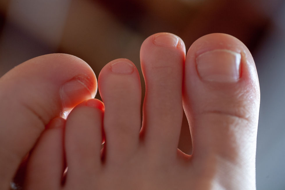 Toenail Care