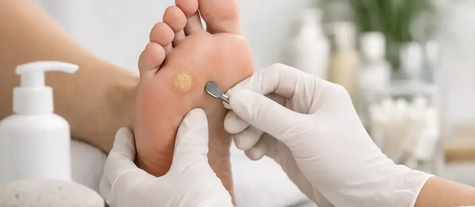 Gloved hands remove a callus from the sole of a foot in a bright spa or clinic, with tools and lotion nearby.