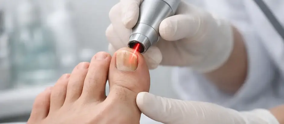 Gloved clinician uses a red laser device on a patient’s big toe in a bright medical setting