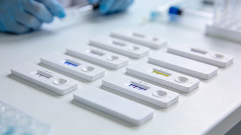 Multiple lateral flow test cassettes arranged on a white lab bench, with visible test and control lines and a blurred laboratory background