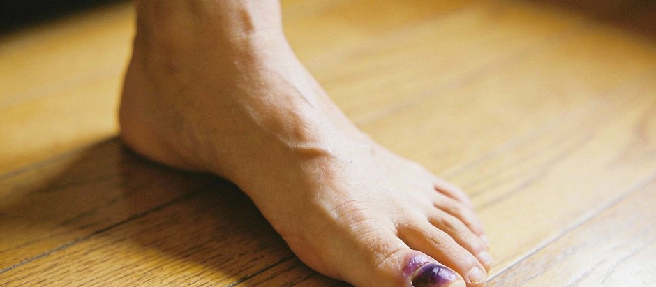 Bruised, swollen little toe on a wooden floor next to a sofa leg, showing a possible toe fracture at home.