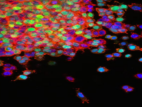 RARE CANCERS AROUND THE WORLD