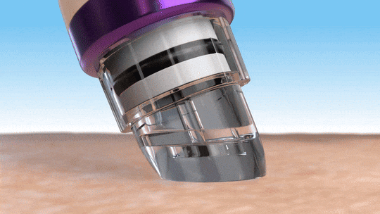 Howdoesthehydradermabrasionworks-ezgif.com-optimize.gif