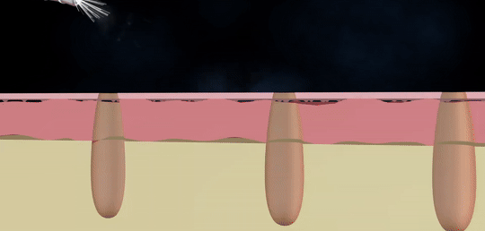 MS4271HowDoestheOxygenSprayFacialWork-ezgif.com-crop.gif