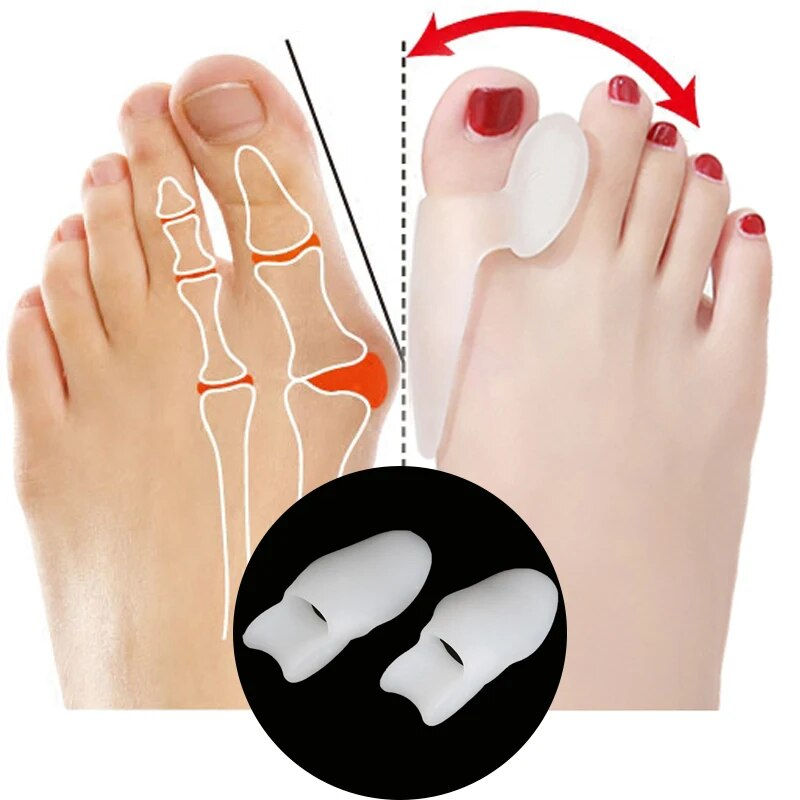 Thumbnail: Silicone Gel Insoles Toe Separator Thumb Valgus Orthopaedic Foot 